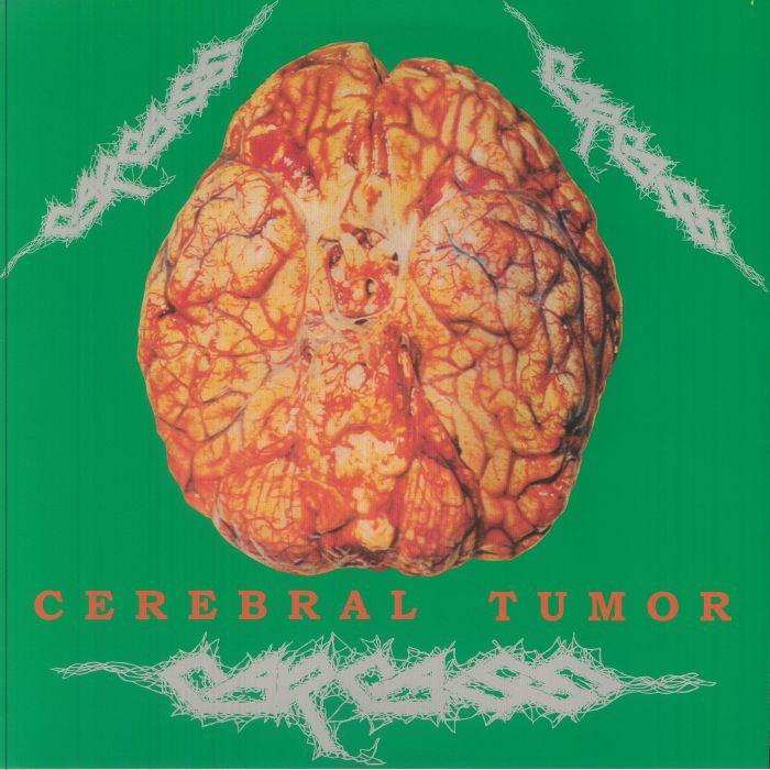 CARCASS - Cerebral Tumor: Brain Washing At Live Station Dortmund Germany 30/07/90 vinyl sleeve